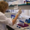 La spin-off de la UPO "Selten Diagnosis" estudia minimizar la biopsia muscular en niños